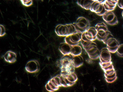 live blood analysis, blood test results, weak white blood cell